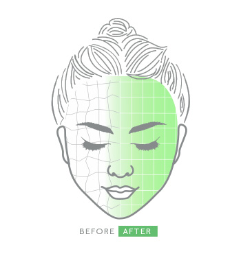 Ein illustriertes Gesicht einer Frau zeigt die Vorher-Nachher-Wirkung bei Anwendung des Clinical Solutions Boosters PHA AHA Resurfacer.