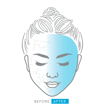 Ein illustriertes Gesicht einer Frau zeigt die Vorher-Nachher-Wirkung bei Anwendung des Clinical Solutions Boosters Ceramide Hydrator.