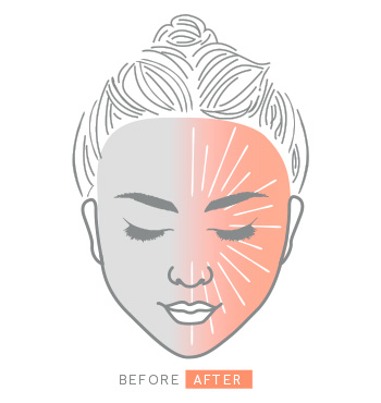 Ein illustriertes Gesicht einer Frau zeigt die Vorher-Nachher-Wirkung bei Anwendung des Clinical Solutions Boosters Ferulic + Niacinamide Brightener.